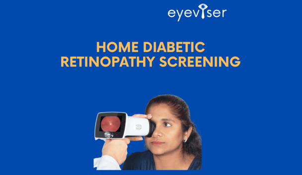Home Diabetic Retinopathy Screening (1 pax)